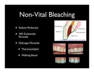 Non-Vital Bleaching
•
•

Sodium Perborate
10% Carbamide
Peroxide
http://www.scritube.com/ﬁles/limba/engleza/health/170_poze/image059.jpg

•

Hydrogen Peroxide

•
•

Thermocatalytic
Walking bleach

 