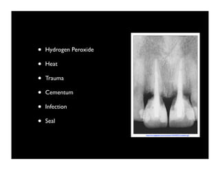 •
•
•
•
•
•

Hydrogen Peroxide
Heat
Trauma
Cementum
Infection
Seal
http://cro.sagepub.com/content/14/4/292/F3.medium.gif

 