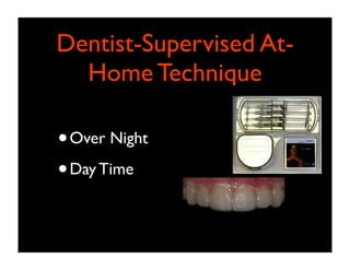 Dentist-Supervised AtHome Technique

• Over Night
• Day Time

 