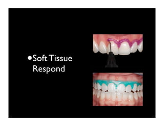 •Soft Tissue
Respond

 