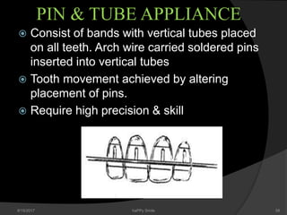 Pin Tube Tooth Contemporary Fixed Orthodontics | PPTX