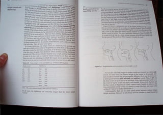 ---- ----. .
- - - - - - -
..
-.-1.ue diide<i 1010 1(' major type'. Imple 'o"el~ faJ
pie vowel, and Engh,h 0 ,." r mODopb!boDI:~ I and diphthongs (Taole , 13 so calltQ
d h h Pure o"e~ .., h uaI' Th -.) S·
. t ong< ...~ noti.: able.: ange In q II)'. e oel of' 11IlPie
o"el d, fI()I "IV . II PII. ~I
and !he fil"[ onc/ 01 sl!Ppose are a 'Imple  0"d D- _. c!!l,
dl!g. b!!.I,P
1
~;,., cdubll 3 c'hange in quali!) "ithin a ingle 'I~hlel"'::~
are one < u~ ..... th d • L.lJ •
D. she" ('haDge' 10 q~Jly al are ue 10 longue movement
diphtho, u.ll ond aru,ulauon 10wards another vo"el ~ LJ a"ay
frOID the 101 .j qualil I' clearl) perceptible in "ord, ~uch a~ sa.' ho
n
. lb;l
h31lf'e IR -oVtc, . . ,. U' .
c ". and bit. In ,ome language, (1Ocluding English) Ihe fu..1 ~. '''''.
Ia. ~7:" /!. mu -h-'oneer and perceptually more salient than Ihe <_. pan ofa
diphuoon£ I' C ,_ • -~Ond
In RP.'there are mne di~hlhhong, andlthey f.1al
l
d
l 1O,tO ~wo c~as e: Cen;rin.
. bth gs and closin,g dipht ongs ca, so ca e c osmg dIphthong ....
dip . ond'phthOn~ dunng lhe final phase of the vowel articulation lh~I'hln a
centnn~ I " . kl ds th . e 19b-
. '1 of the IOneue move. qUlc' ) towar e centre of the mouth
elpotn. . ' f ' -!he
lpicaJ po,ition il 3 ume for the artlculauon ° sch"a I(OIJ). Ihe O"el at the
~innjng of the ord gddrefS. Thlerie ~ four centnng dIphthong _namel~
(Ia). as in dear. cheer. and clear. ea as to r;re- wea;. and aIr. [0;» as boo;
SIlrt!. and dour. and [:-a) as in QflL. shQLe. an ~oar. ~O"ad~)o,. [;)a) and [U~·
are dbappeanng from ~ and man) other ,llI~~lJe~ O.f Bnu,h Engli h. The;
are being replaced b~ [J.J. A< a re ult. "ord like pal<. pore. and poor rhv
~Ith each oIher. The) all come OUt a. [pJ:J. .llIe
In closing diphlhong·. lhe tongue ,!arb in a relatively low po ition and
ends up in a hIgh po JUon euher In the palatal area at the front of the mouth'
lhe regIon where the glide [j] is aniculated. or at the back of the mouth in ~
'elararea where lhe glide [wJ is produced. There are three clo. ing diphthono
lhat end in /I}. They are [elJ which is found in ...ay. l<'t!igJrI. and lail; [all Whi~h
I, found tn lie. buy. and m)~ and [::II} which is found in oil. boy. and COin
There are only tO diphthong.. in ~hich the LOngue move up to [oj. nameh
lauJ as in no. go. and rIo,," and {<lUJ which occur<; in proud. lo;n, and round.
Table 2.13 Some
Smrpie ,'"",d Diphllumg
I'll [I) bile [all
pel leI sa} lei.
pon )~;J aIr I~j
po! [oj beer [I~)
pal 1a:1 lOY I I)
polt 'A) oar 1'J~)
pan (n) poor [')~J
now ,ooJ
grow [;)OJ
O~ The colon UJdicate ee seclion 6.3 below.)
In all ClI
lov.e' I
• !he diphthongs are SOmCv.hal longer than the hon Imple
6.2
Basic parameters for
describing "o",els
PHU lK
0 eI anu..:u1auons are not ~y to feel con
IIlce Ihe "ocal (r3<,t .. lOI nanov.cd """"'" ,
  much T" bcc~
 0/0 e anIL-U alJOn. ahernaJcy pronounce lhe ds --- 1Icd
feel the: longue mme from a hi!h fmnl "I,,,. '-k" /uo and poe YOlt
liu longue mmement. ahem:lIe be'ttn the: v Is POS·.on you ree
feel the longue mm Ing fr m the: I"" hac" (._.~~ "'~ p<:'1 and pal Y U II
. ' r ~"' uoc ........ II be --·'d
arne lime) 10 10" ronl posItiOn ("lib the: L. unrounded ._OU< "'be
be!ween Ibe '0 cis of h.... ~nu .. h". You w.1I notICe that' ~'nall~. Iana1c
mOement between the high lront and high hack ~ I In • on to longue
your lips for the [u:. Y"'."OQ. yoo are" In&
Figure 2.8 h"" s " mid agma vie... oj the lonoue """ition' ....
["J [J d [ . b' d X . .c ,..-- .0< UK' vov.el
I •• a •an u. ,iL<e on. ·ray, ludle of C:.nadlan Engli h.lbese ('
vowe" are V~f) "mllarto Ihe Bmi,h RP f:nglilh 'o.... els~ribed alx!
~
onl~. o"elln lhefigure Ibat needs~pec1a1 comment is [01 Thl • Itt..: the:
~ntl h vowel [0) tnPOI: The ?nly Ignificanl difference 1 that Canadian {ul
" fo~ed "'lib the hp' "'. a falfly neutral po itton ....hile RP {ol" made ""ib
the hp' pur<ed. The po tUon of the tongue IS 'irtually!he same
I
Figure 2.8 Tongue po5l!Xln and tra!lSCJllIion for tIYee ~ vowel<..
'owel for v.hlch the t n!!ue I' neither r:nsed nor lowered are called mid
oweL. In some ea--e. the ~latt,e height of the tongue ID the general mid
zone reo ul~ in ov.eL th t are perceptiblY different. SQ It ma~ be nec saIJ
to dl. tin!!lli.h betwL-en mid. mid·high and mid·low oweb. Thu ID RP.(el
the ITOm'I·ov.cl (If Sfl I. aid to be mid-high. front. and umounded v.hile lJ:}
lhe 1 ov. el of 'IOnIl,i mid-low, ba.:k. and rounded. Sctl.....a ([:Ill. th f1f'ot and
the' IloeL-of ladonna i a mid. central lowel imilar to hwa i the
I O!: unmunded cen.rnl ,o;el [3:) found tn v.ord like b!!d. d II ~ ( ee
ti n 0.3 b.:lo ~ r funher discus ion
l!nfoltunat ly. there are no lear -ulon pomt' l>et n van t ngue
hClght po IlIon Hence It i not alw ). ob ;tOll> v.hetha a uod ould be
 