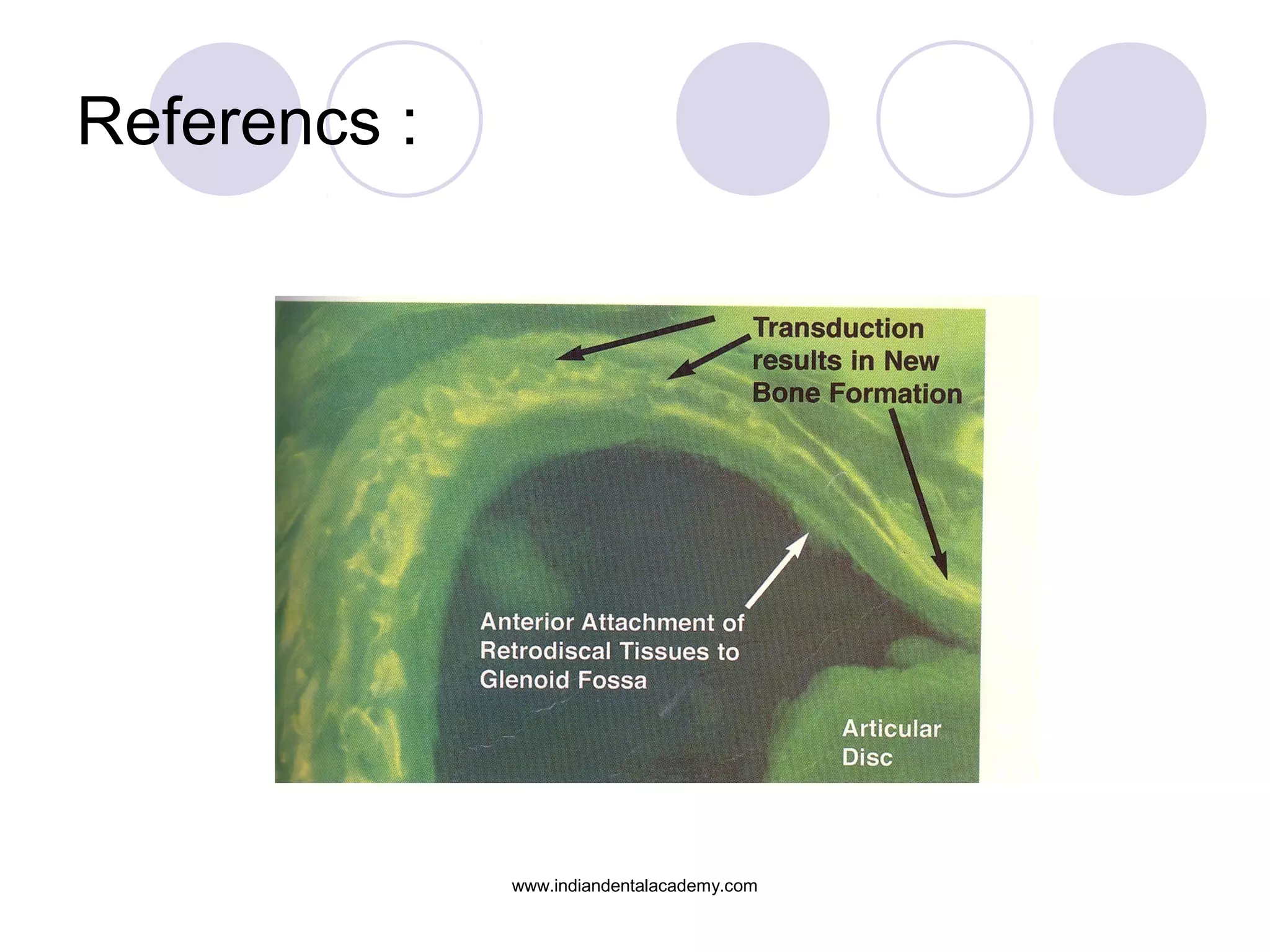 Referencs :
www.indiandentalacademy.com
 