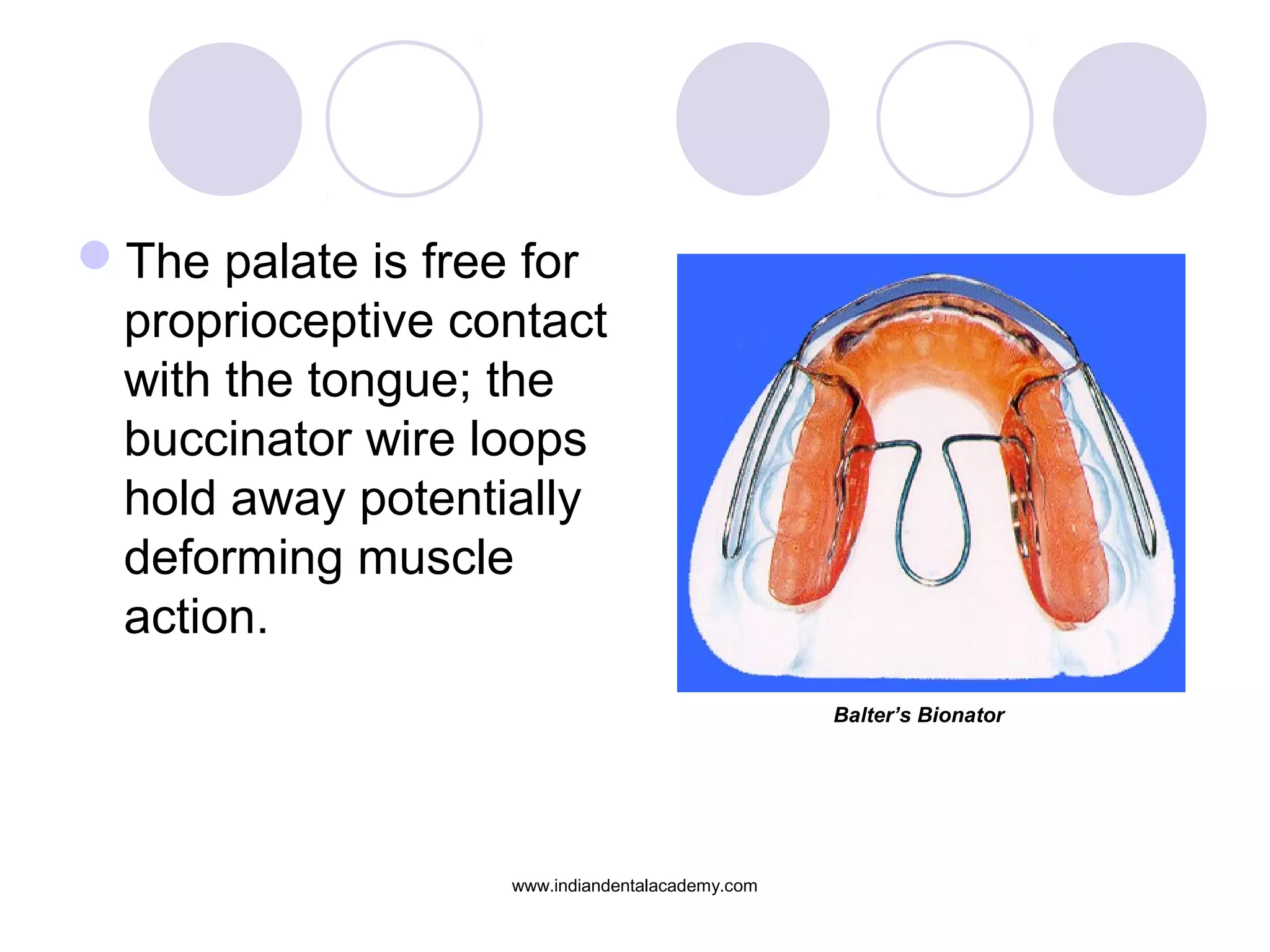 The palate is free for
proprioceptive contact
with the tongue; the
buccinator wire loops
hold away potentially
deforming muscle
action.
Balter’s Bionator
www.indiandentalacademy.com
 