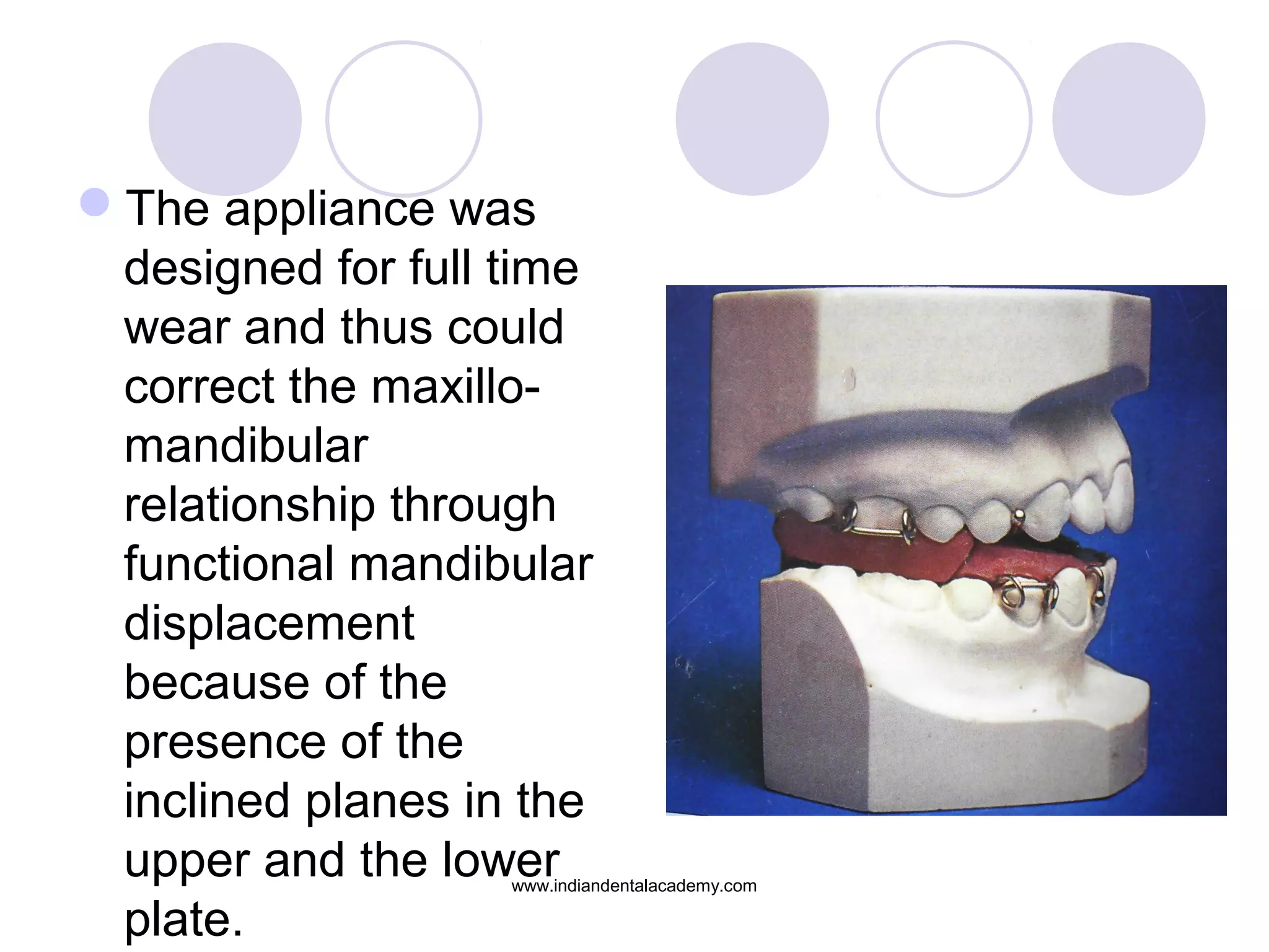 The appliance was
designed for full time
wear and thus could
correct the maxillo-
mandibular
relationship through
functional mandibular
displacement
because of the
presence of the
inclined planes in the
upper and the lower
plate.
www.indiandentalacademy.com
 