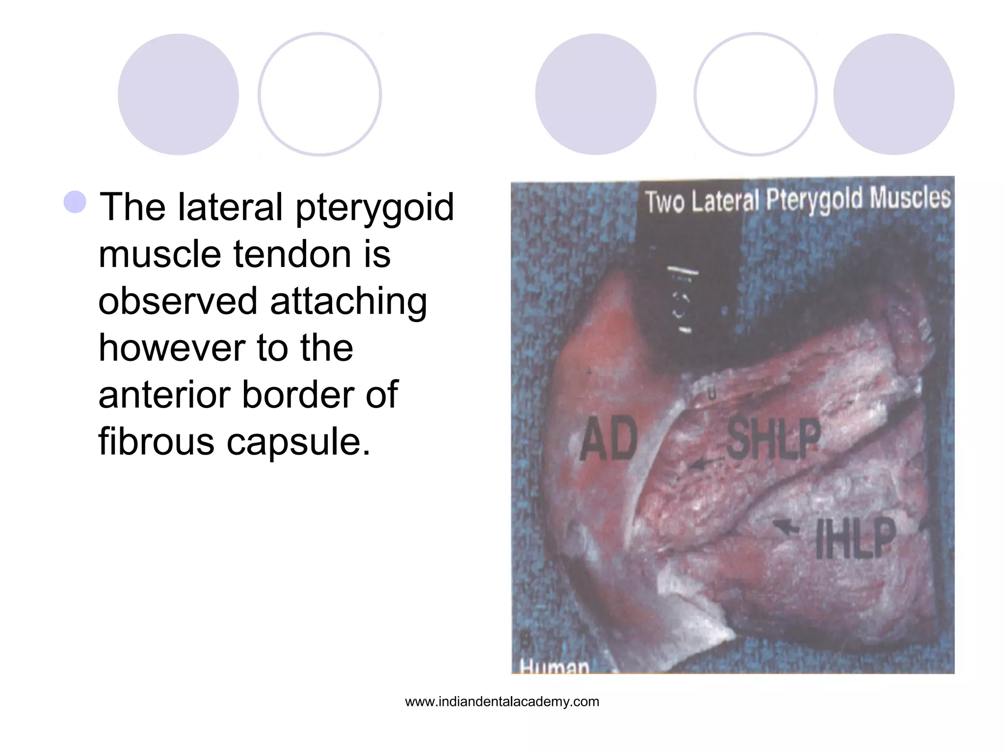 The lateral pterygoid
muscle tendon is
observed attaching
however to the
anterior border of
fibrous capsule.
www.indiandentalacademy.com
 