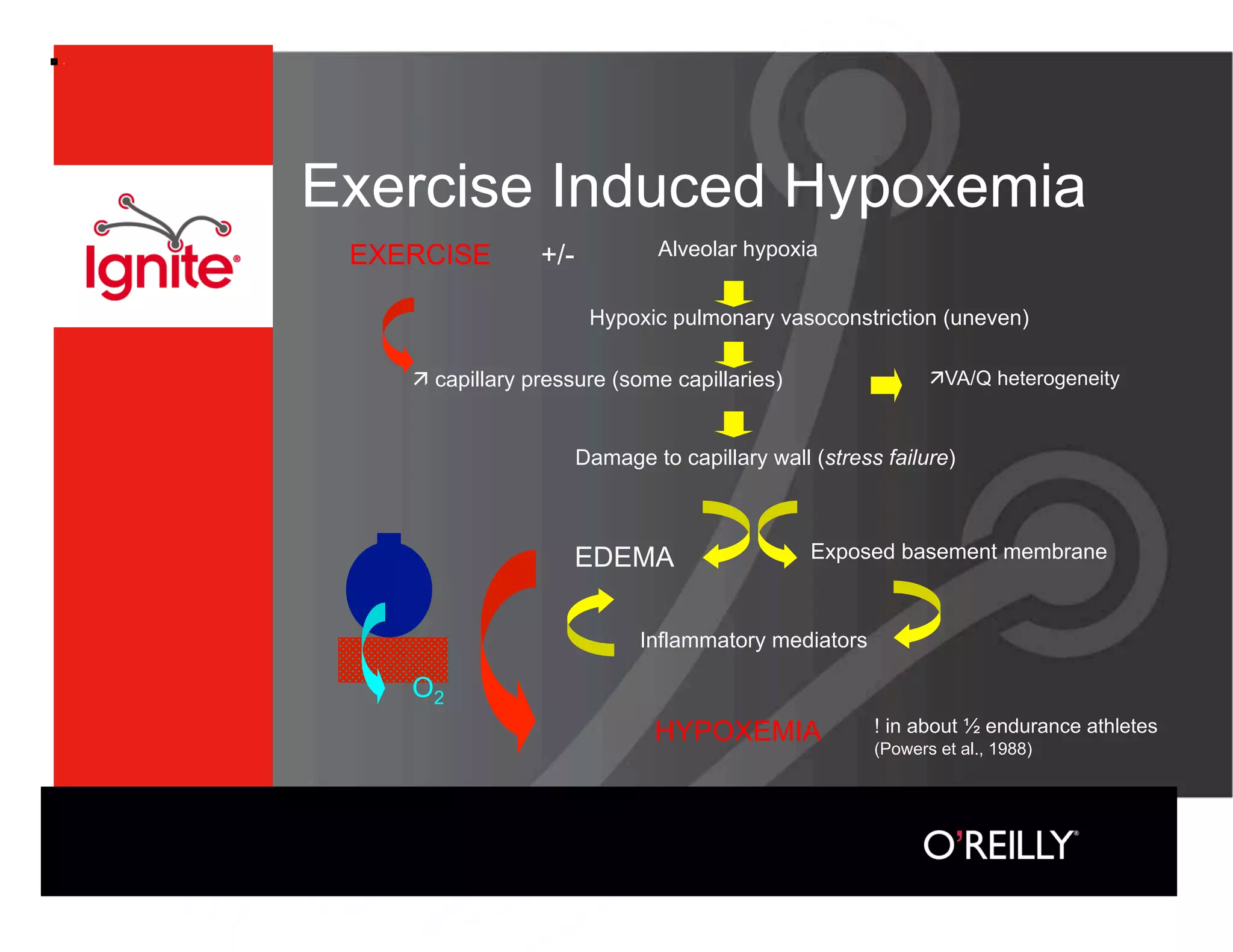 Exercise Induced Hypoxemia
 EXERCISE        +/-           Alveolar hypoxia


                        Hypoxic pulmonary vasoconstriction (uneven)

     capillary pressure (some capillaries)                    VA/Q heterogeneity


                       Damage to capillary wall (stress failure)



                       EDEMA                    Exposed basement membrane



                             Inflammatory mediators

    O2
                               HYPOXEMIA               ! in about ½ endurance athletes
                                                       (Powers et al., 1988)
 