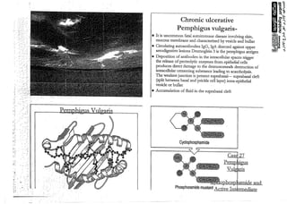ulcer