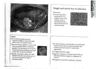 ulcer