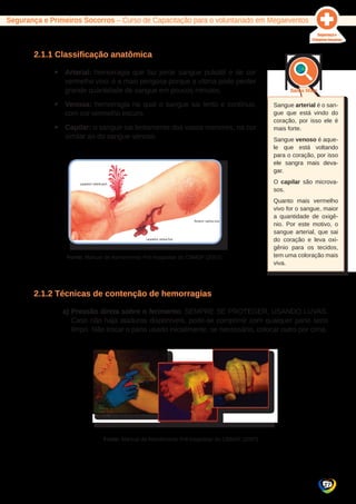 Segurança e Primeiros Socorros – Curso de Capacitação para o voluntariado em Megaeventos 
27 
2.1.1 Classificação anatômica 
yy Arterial: hemorragia que faz jorrar sangue pulsátil e de cor 
vermelho vivo; é a mais perigosa porque a vítima pode perder 
grande quantidade de sangue em poucos minutos. 
yy Venosa: hemorragia na qual o sangue sai lento e contínuo, 
com cor vermelho escuro. 
yy Capilar: o sangue sai lentamente dos vasos menores, na cor 
similar ao do sangue venoso. 
Fonte: Manual de Atendimento Pré-hospitalar do CBMDF (2007). 
2.1.2 Técnicas de contenção de hemorragias 
a) Pressão direta sobre o ferimento: SEMPRE SE PROTEGER, USANDO LUVAS. 
Caso não haja ataduras disponíveis, pode-se comprimir com qualquer pano seco 
limpo. Não trocar o pano usado inicialmente, se necessário, colocar outro por cima. 
Fonte: Manual de Atendimento Pré-hospitalar do CBMDF (2007) 
Sangue arterial é o san-gue 
que está vindo do 
coração, por isso ele é 
mais forte. 
Sangue venoso é aque-le 
que está voltando 
para o coração, por isso 
ele sangra mais deva-gar. 
O capilar são microva-sos. 
Quanto mais vermelho 
vivo for o sangue, maior 
a quantidade de oxigê-nio. 
Por este motivo, o 
sangue arterial, que sai 
do coração e leva oxi-gênio 
para os tecidos, 
tem uma coloração mais 
viva. 
 