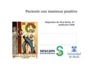 Paciente con mantoux positivo
Alejandro de Gea Grela. 6º
medicina UAH
 