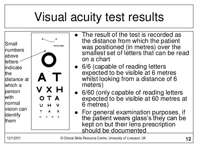 eye result test 6/9 Cranial Nerve of Continuation Exam eye result test 6/9 Cranial Nerve of Continuation Exam