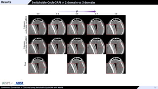 Continuous Conversion of CT Kernel using Switchable CycleGAN with AdaIN ...