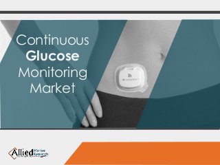 Continuous 
Glucose 
Monitoring 
Market 
 