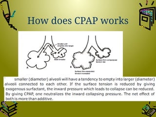 Understanding Cpap Comprehensive Overview of Neonatal CPAP Therapy: Principles ...