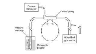 Cpap Point 3 CONTINUOUS POSITIVE AIRWAY PRESSURE (CPAP).pptx