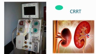 Continuous renal replacement therapy crrt | PPTX