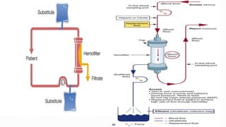 Continuous renal replacement therapy crrt | PPTX
