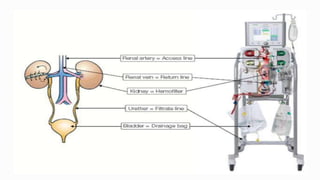 Continuous renal replacement therapy crrt | PPTX