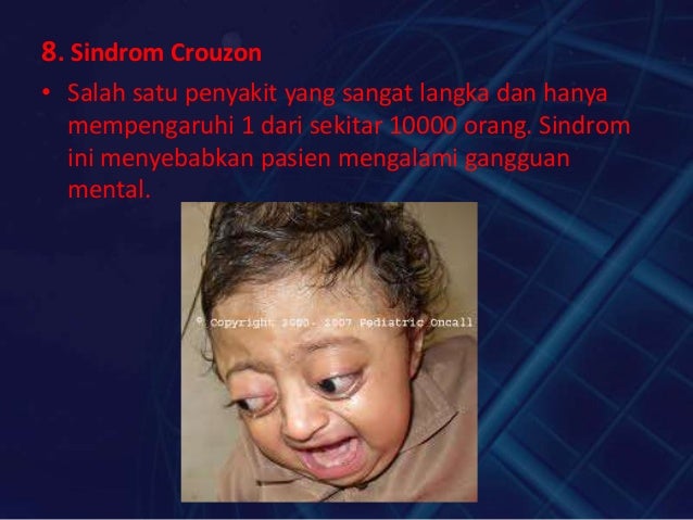 penyakit mental yang langka Contoh contoh mutasi gezan girya noor m rizki w r penyakit mental yang langka Contoh contoh mutasi gezan girya noor m rizki w r
