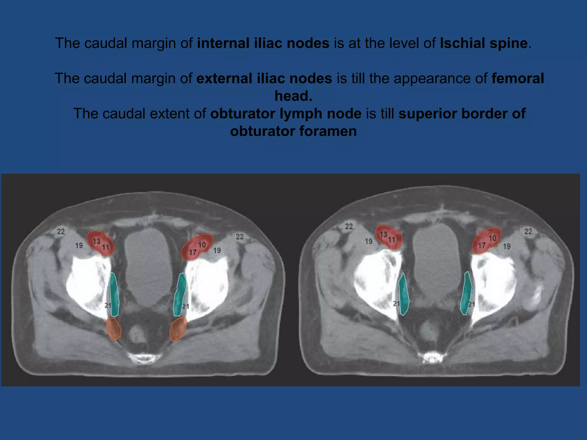 Contouring guidelines Cervix IMRT | PPTX