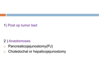 1) Post op tumor bed
2 ) Anastomoses
 Pancreaticojejunostomy(PJ)
 Choledochal or hepaticojejunostomy
 