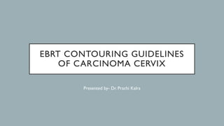 EBRT CONTOURING GUIDELINES
OF CARCINOMA CERVIX
Presented by- Dr. Prachi Kalra
 