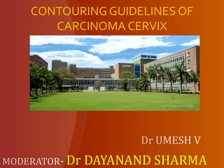 CONTOURING GUIDELINES OF
CARCINOMA CERVIX
 