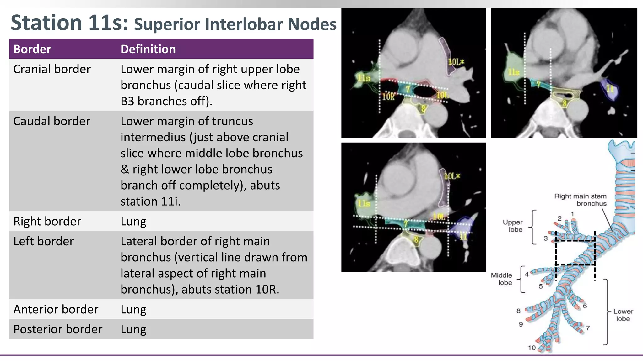 Contouring of CTV Lymph nodes in NSCLC (Part III) | PPT