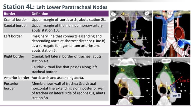 Contouring of CTV Lymph nodes in NSCLC (Part III) | PPT