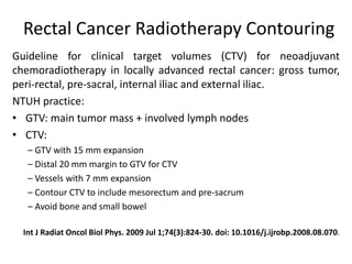 Rectal Cancer Radiotherapy Contouring
Guideline for clinical target volumes (CTV) for neoadjuvant
chemoradiotherapy in locally advanced rectal cancer: gross tumor,
peri-rectal, pre-sacral, internal iliac and external iliac.
NTUH practice:
• GTV: main tumor mass + involved lymph nodes
• CTV:
– GTV with 15 mm expansion
– Distal 20 mm margin to GTV for CTV
– Vessels with 7 mm expansion
– Contour CTV to include mesorectum and pre-sacrum
– Avoid bone and small bowel
Int J Radiat Oncol Biol Phys. 2009 Jul 1;74(3):824-30. doi: 10.1016/j.ijrobp.2008.08.070.
 