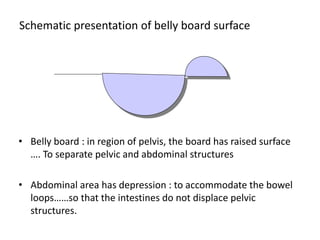 Schematic presentation of belly board surface
• Belly board : in region of pelvis, the board has raised surface
…. To separate pelvic and abdominal structures
• Abdominal area has depression : to accommodate the bowel
loops……so that the intestines do not displace pelvic
structures.
 