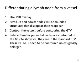 Differentiating a lymph node from a vessel
1. Use MRI overlay
2. Scroll up and down: nodes will be rounded
structures that disappear then reappear
3. Contour the vessels before contouring the GTV
4. Sub-centimeter perirectal nodes are contoured in
the GTV to show you they are in the standard CTV.
These DO NOT need to be contoured unless grossly
enlarged.
25
 