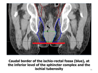 56
Caudal border of the ischio-rectal fossa (blue), at
the inferior level of the sphincter complex and the
ischial tuberosity
 
