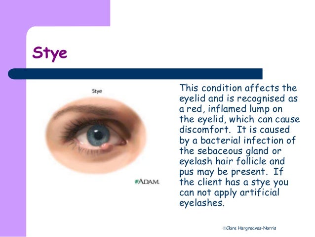 Contra indications Stue skab