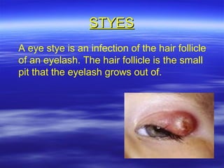 Contra indications to facials | PPT