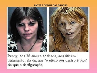 ANTES E DEPOIS DAS DROGAS
 