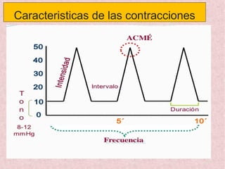 Caracteristicas de las contracciones
 