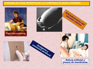 VARIABLES QUE MODIFICAN LA CONTRACTILIDAD UTERINA
Posición materna
Analgesia y
anestesia peridural
Rotura artificial y
precoz de membranas
Sobredistensión del
volumen uterino
 