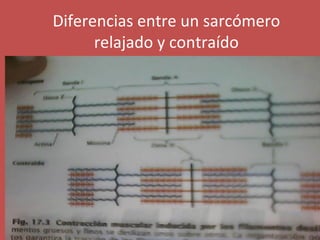 Diferencias entre un sarcómero 
relajado y contraído 
 