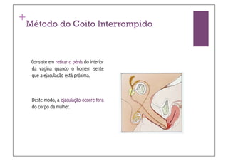 +
Método do Coito Interrompido



    Consiste em retirar o pénis do interior
    da vagina quando o homem sente
    que a ejaculação está próxima.



    Deste modo, a ejaculação ocorre fora
    do corpo da mulher.
 