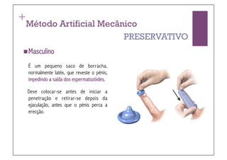 +
Método Artificial Mecânico
                       PRESERVATIVO
 Masculino

    É um pequeno saco de borracha,
    normalmente latéx, que reveste o pénis,
    impedindo a saída dos espermatozóides.

    Deve colocar-se antes de iniciar a
    penetração e retirar-se depois da
    ejaculação, antes que o pénis perca a
    erecção.
 