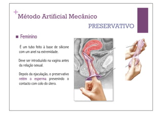 +
 Método Artificial Mecânico
                                           PRESERVATIVO
  Feminino

    É um tubo feito à base de silicone
    com um anel na extremidade.

 Deve ser introduzido na vagina antes
 da relação sexual.

    Depois da ejaculação, o preservativo
    retém o esperma prevenindo o
    contacto com colo do útero.
 