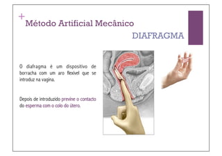 +
   Método Artificial Mecânico
                             DIAFRAGMA


O diafragma é um dispositivo de
borracha com um aro flexível que se
introduz na vagina.


Depois de introduzido previne o contacto
do esperma com o colo do útero.
 