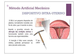 +
Método Artificial Mecânico
                     DISPOSITIVO INTRA-UTERINO

 O DIU é um pequeno dispositivo de
plástico, normalmente revestido com
fio de cobre, que é inserido no útero.

Impede a gravidez através da
 alteração das condições uterinas e
 funcionando também como uma
 barreira aos espermatozóides.

 A inserção é feita numa consulta
médica, podendo permanecer no
útero durante vários anos.
 