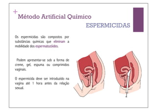 +
  Método Artificial Químico
                         ESPERMICIDAS
Os espermicidas são compostos por
substâncias químicas que eliminam a
mobilidade dos espermatozóides.


 Podem apresentar-se sob a forma de
creme, gel, espuma ou comprimidos
vaginais.

O espermicida deve ser introduzido na
vagina até 1 hora antes da relação
sexual.!
 