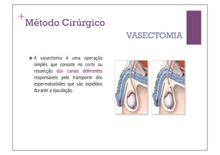 +
 Método Cirúrgico
                                        VASECTOMIA

    A vasectomia é uma operação
    simples que consiste no corte ou
    ressecção dos canais deferentes
    responsáveis pelo transporte dos
    espermatozóides que são expelidos
    durante a ejaculação.
 