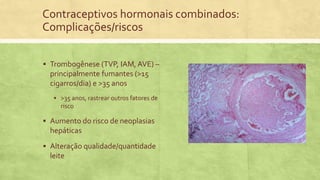 Contraceptivos hormonais combinados:
Complicações/riscos
 Trombogênese (TVP, IAM, AVE) –
principalmente fumantes (>15
cigarros/dia) e >35 anos
 >35 anos, rastrear outros fatores de
risco
 Aumento do risco de neoplasias
hepáticas
 Alteração qualidade/quantidade
leite
 