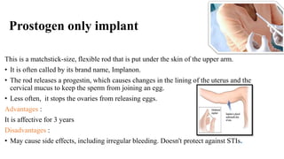 Prostogyn Injection Newer techniques of sterilization & contraception ,injectable ...