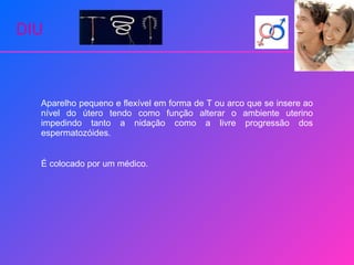DIU Aparelho pequeno e flexível em forma de T ou arco que se insere ao nível do útero tendo como função alterar o ambiente uterino impedindo tanto a nidação como a livre progressão dos espermatozóides. É colocado por um médico. 